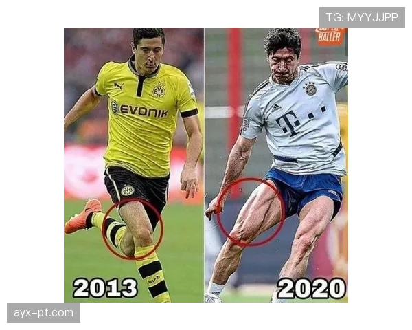 莱万多夫斯基肌肉伤病恢复 莱万多夫斯基肌肉伤病恢复